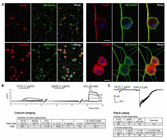 Cartilage-binding antibodies induce pain through immune complex–mediated activation of neurons