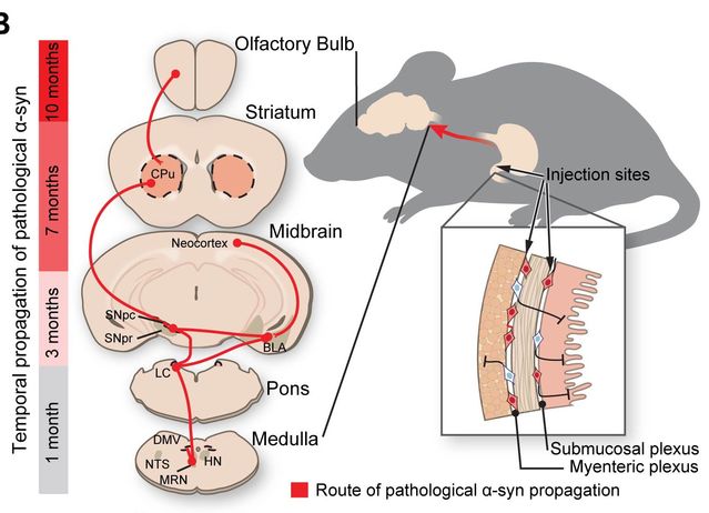 Parkinson's Disease-Causing Protein Hijacks Gut-Brain Axis