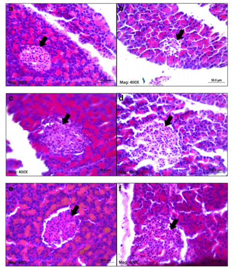 Hypoglycaemic activity of ethanolic extract of Garcinia mangostana Linn. in normoglycaemic and strept